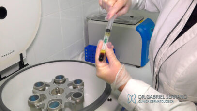 14.-Plasma-rico-en-plaquetas-redimensionado